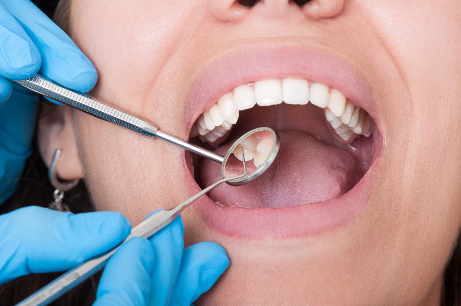 Hacer un tratamiento dental en Santiago